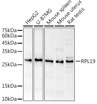 RPL19 Rabbit Polyclonal Antibody (CAB20552)