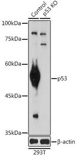 Anti-p53 Antibody (CAB5761)[KO Validated]