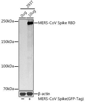 MERS-CoV Spike RBD Rabbit Polyclonal Antibody (CAB20565)