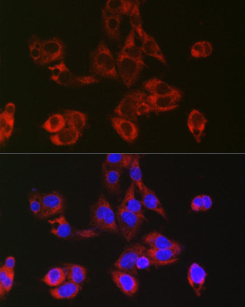 RPL39 Rabbit Polyclonal Antibody (CAB20603)