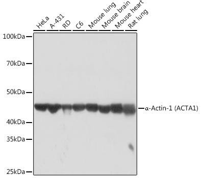α-Actin-1 (ATCA1) Rabbit Monoclonal Antibody (CAB2280)