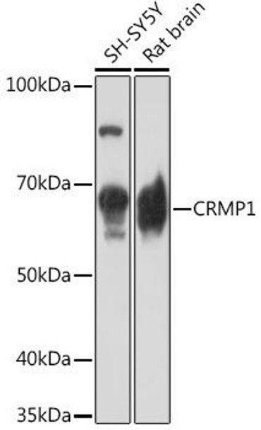 CRMP1 Rabbit Monoclonal Antibody (CAB2390)