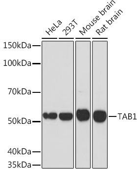 TAB1 Rabbit Monoclonal Antibody (CAB3306)