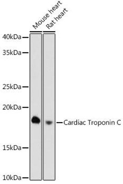 Cardiac Troponin C Rabbit Monoclonal Antibody (CAB3816)
