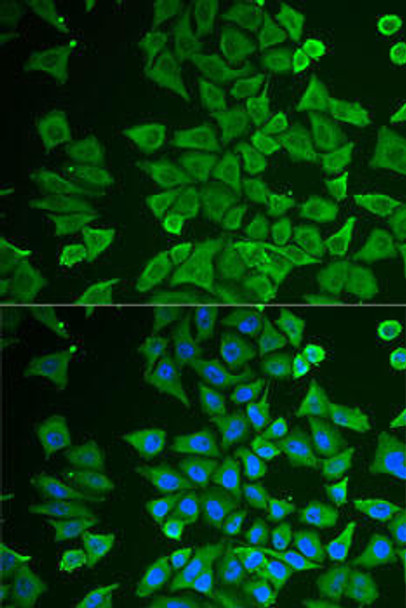 Anti-DDAH2 Antibody (CAB6457)