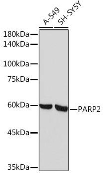 PARP2 Rabbit Monoclonal Antibody (CAB5945)