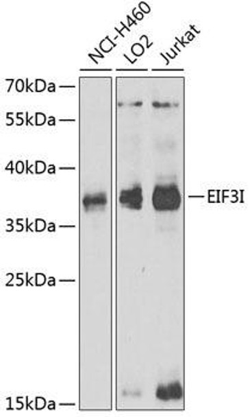 Anti-EIF3I Antibody (CAB6582)