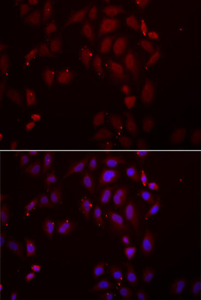 Anti-FRZB Antibody (CAB6592)