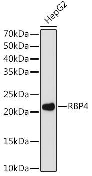 RBP4 Rabbit Monoclonal Antibody (CAB8807)