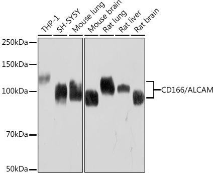 CD166/ALCAM Rabbit Monoclonal Antibody (CAB9727)