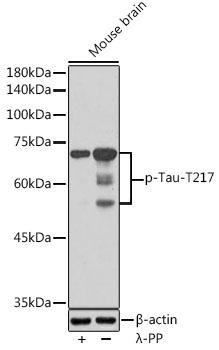 Phospho-Tau-T217 Rabbit Polyclonal Antibody (CABP1233)