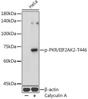 Phospho-PKR/EIF2AK2-T446 Rabbit Polyclonal Antibody (CABP1251)