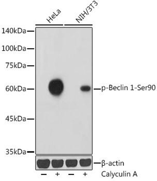 Phospho-Beclin 1-Ser90 Rabbit Polyclonal Antibody (CABP1254)