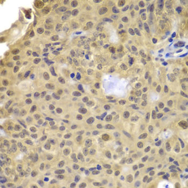 Anti-Cyclin A2 Antibody (CAB7632)