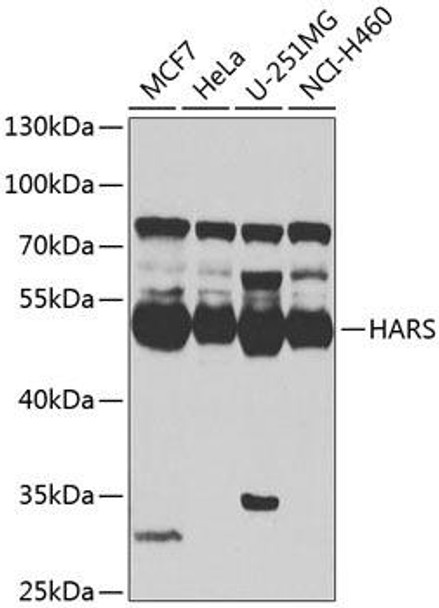 Anti-HARS Antibody (CAB7899)