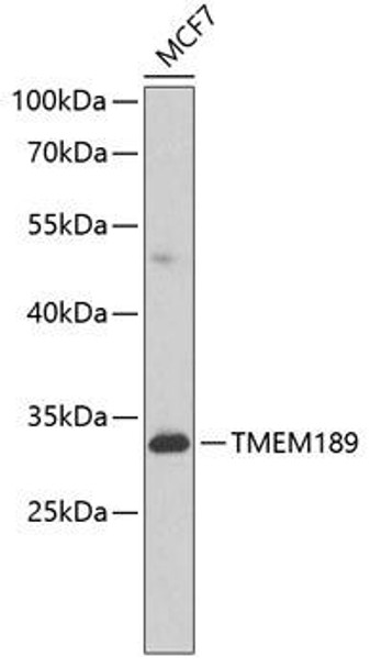 Anti-TMEM189 Antibody (CAB8380)