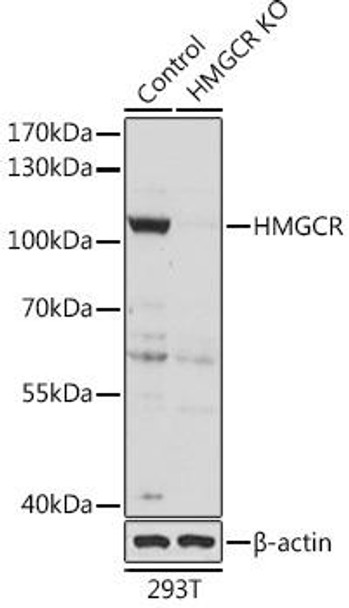 Anti-HMGCR Antibody (CAB16876)[KO Validated]