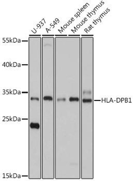 Anti-HLA-DPB1 Antibody (CAB17495)