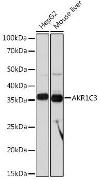 Anti-AKR1C3 Antibody (CAB3884)