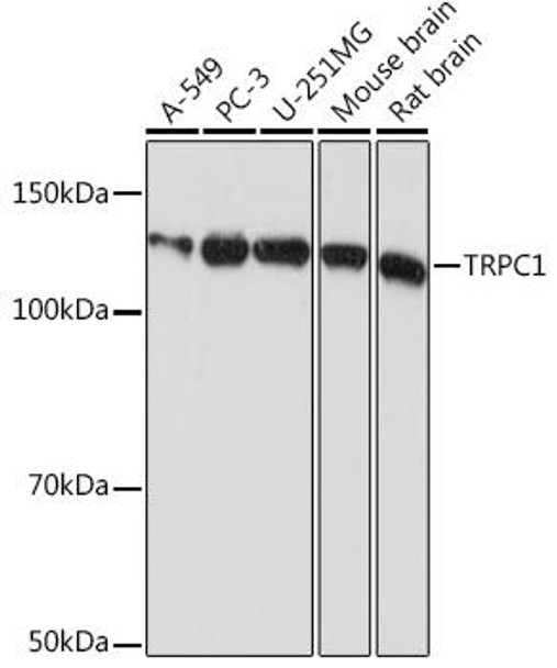Anti-TRPC1 Antibody (CAB4016)