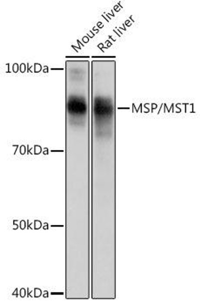 Anti-MSP/MST1 Antibody (CAB0109)