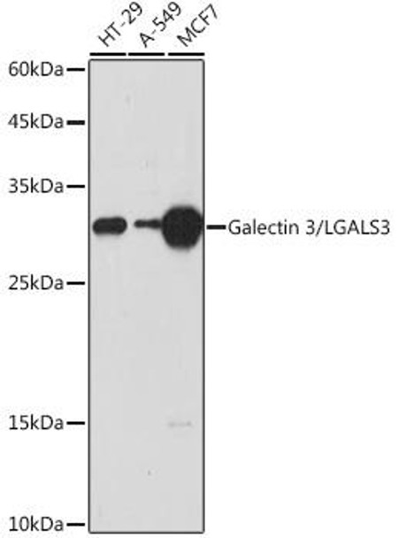Anti-Galectin 3/LGALS3 Antibody (CAB14619)