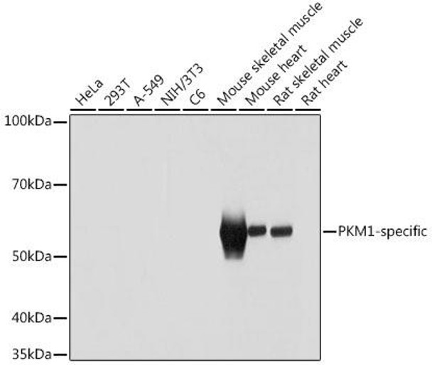 Anti-PKM1-specific Antibody (CAB18800)