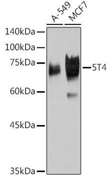 Anti-5T4 Antibody (CAB19541)