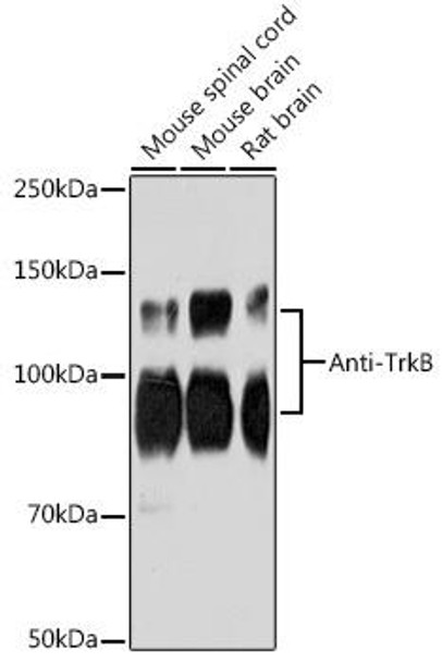 Anti-Anti-TrkB Antibody (CAB19832)