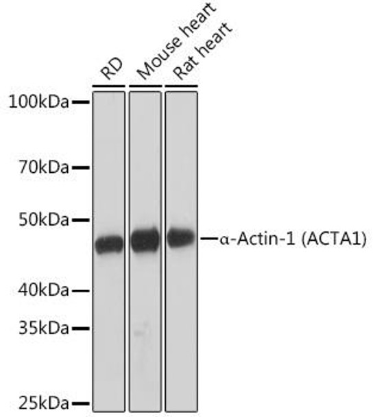 Anti-alpha-Actin-1 (ACTA1) Antibody (CAB2235)