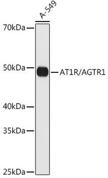 Anti-AT1R/AGTR1 Antibody (CAB4140)