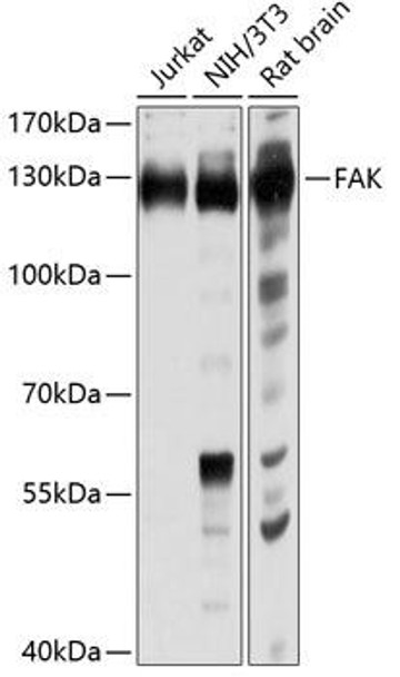 Anti-FAK Antibody (CAB0024)