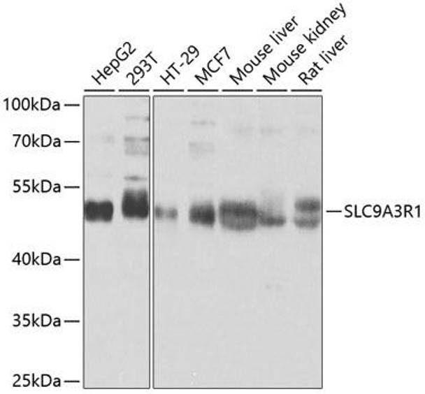 Anti-SLC9A3R1 Antibody (CAB0146)