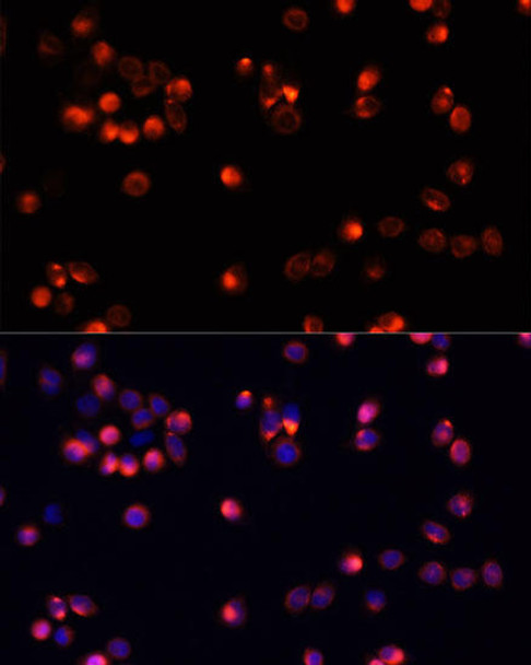 Anti-AKT2 Antibody (CAB0336)