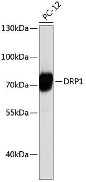 Anti-DRP1 Antibody (CAB0650)