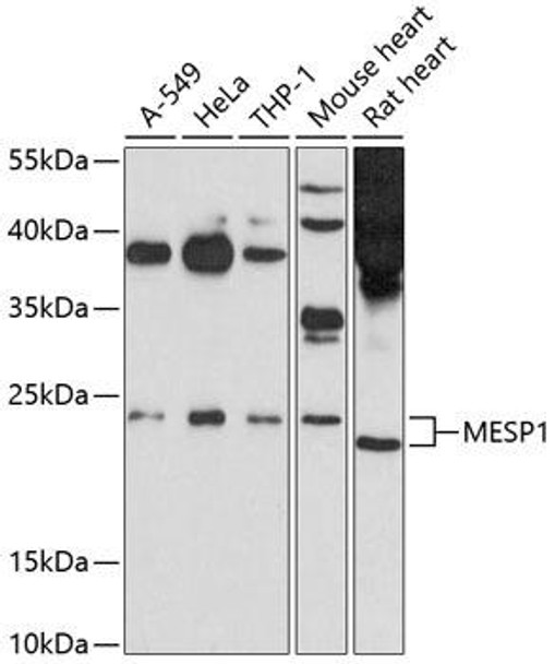 Anti-MESP1 Antibody (CAB10148)