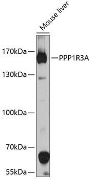 Anti-PPP1R3A Antibody (CAB10171)