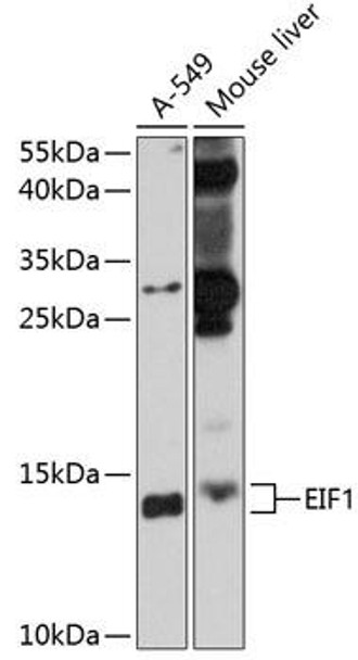 Anti-EIF1 Antibody (CAB10785)