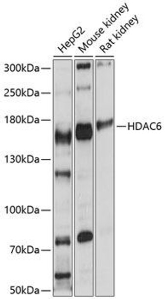Anti-HDAC6 Antibody (CAB11261)