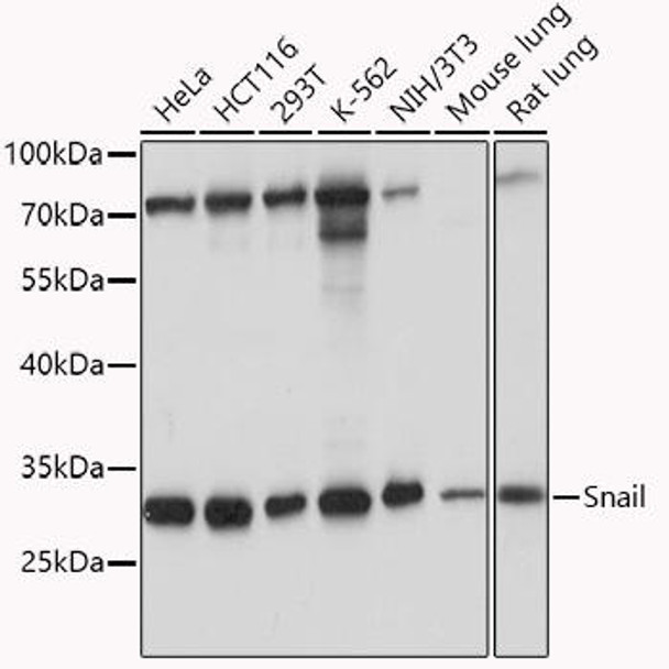 Anti-Snail Antibody (CAB11794)