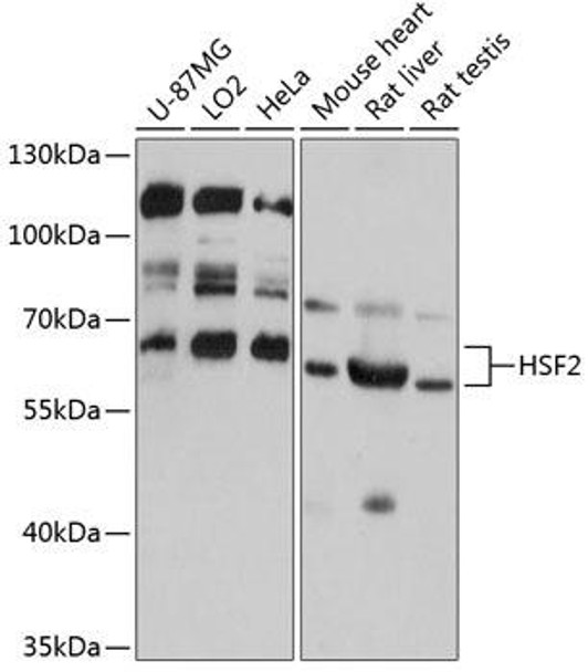 Anti-HSF2 Antibody (CAB12264)