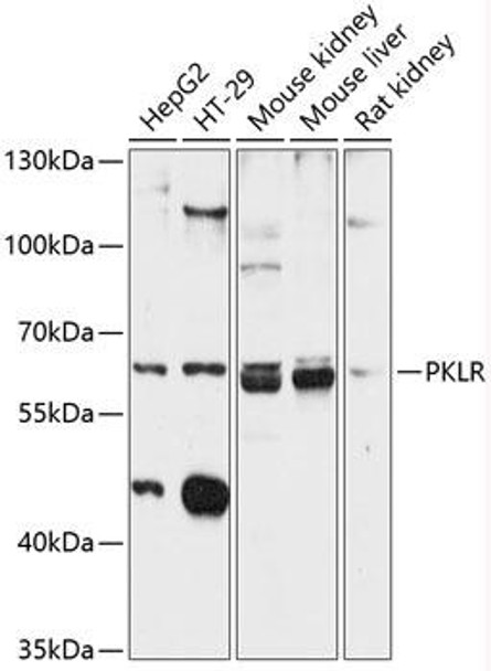 Anti-PKLR Antibody (CAB12336)