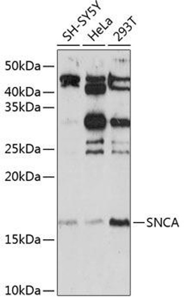 Anti-SNCA Antibody (CAB13354)