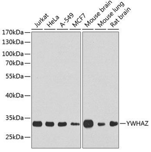 Anti-YWHAZ Antibody (CAB13370)
