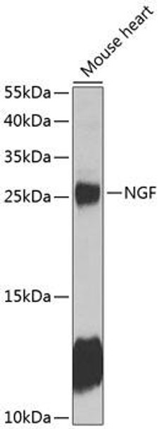 Anti-NGF Antibody (CAB13922)