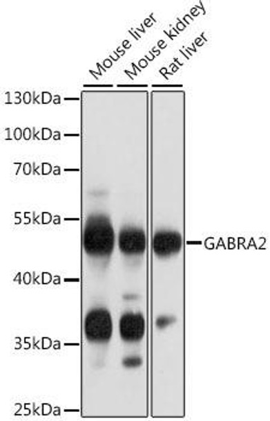 Anti-GABRA2 Antibody (CAB14185)