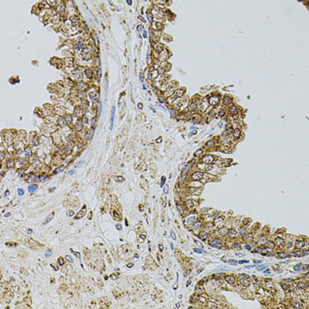 Anti-SELP Antibody (CAB1425)