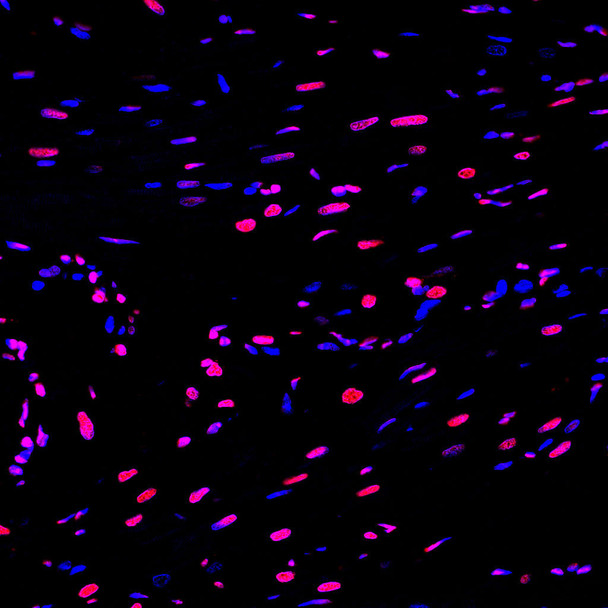 TUNEL 1-Step In Situ Apoptosis Kit (FL555) (AKES075)