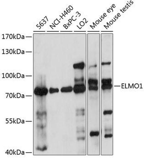 Anti-ELMO1 Antibody (CAB14830)