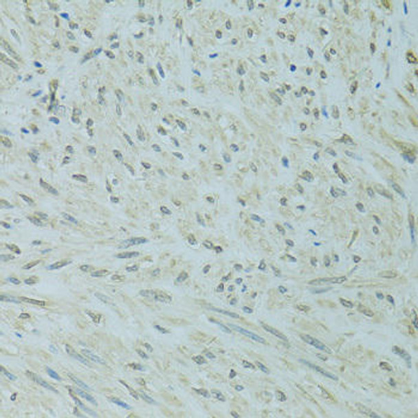 Anti-XBP1 Antibody (CAB14860)